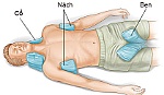 Cách dự phòng và sơ cứu khi bị sốc nhiệt do nắng nóng