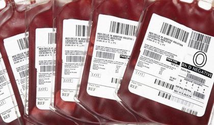 Các kháng nguyên quyết định một người thuộc nhóm máu nào. (Ảnh: Wisegeekhealth).