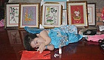 Tuổi 20 của cô gái mắc bệnh xương thủy tinh