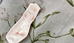 Dị vật đường thở, mối nguy hiểm khôn lường
