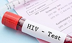 Thử nghiệm thành công giai đoạn đầu vắcxin mới phòng HIV/AIDS
