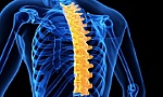 Nhận biết 4 dạng vẹo cột sống