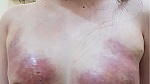 Làm đẹp đón tết: Coi chừng rước họa