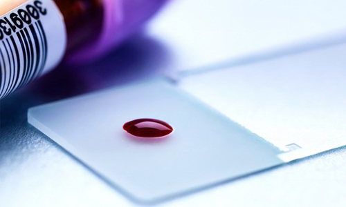 Thiết bị mới này chỉ cần một giọt máu. (Nguồn: futurity.org)