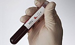 Người thứ hai trên thế giới chữa khỏi HIV