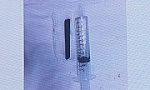 Đoạn đũa dài 7cm nằm trong hốc mắt bệnh nhân hơn 4 năm