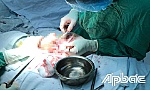 Bệnh viện 120: Cấp cứu kịp thời bệnh nhân đứt gần lìa bàn tay