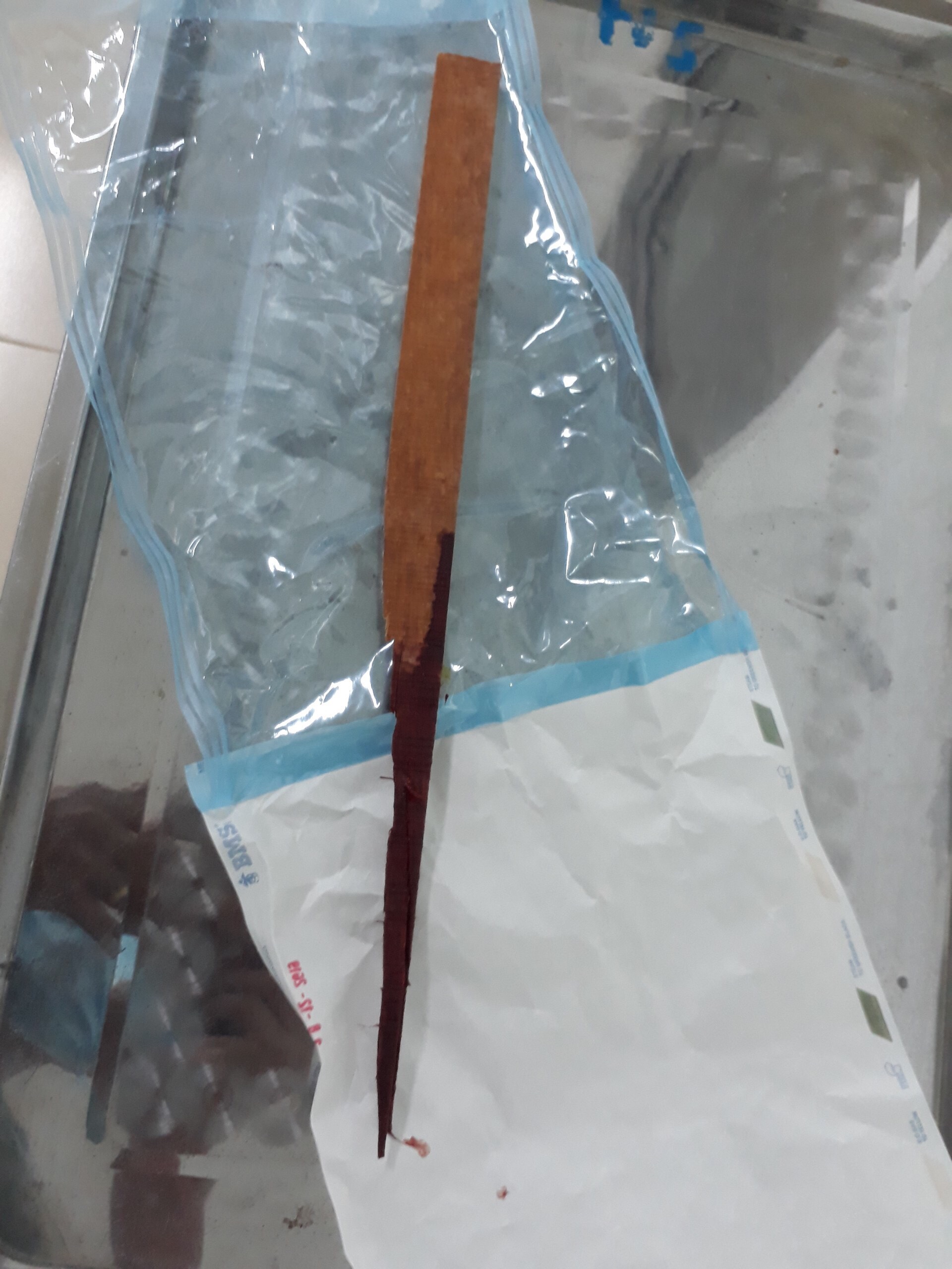 Thanh gỗ dài khoảng nửa mét được lấy ra khỏi cơ thể bệnh nhân V.