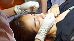 Cảnh báo biến chứng khi làm đẹp bằng phương pháp lột da