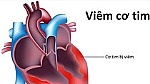 Không tồn tại virus lạ gây viêm cơ tim