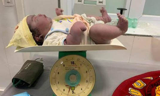 Sản phụ sinh thường bé nặng 5,5kg