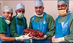 Phẫu thuật cắt bỏ quả thận khổng lồ nặng 7,4kg của bệnh nhân