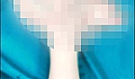 Nổ điện thoại, bàn tay cậu bé 16 tuổi dập nát