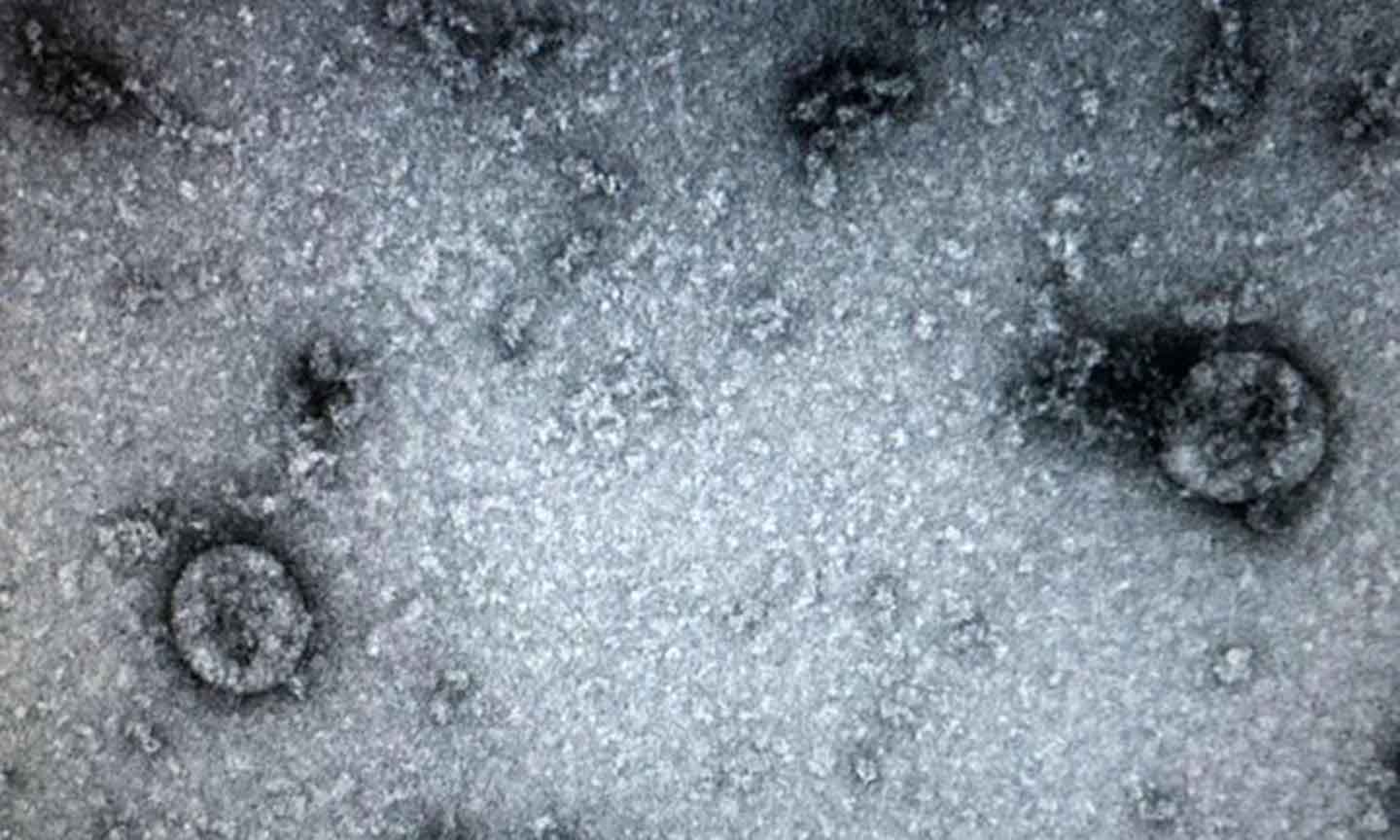 Virus corona chủng mới được Viện Vệ sinh dịch tễ trung ương nuôi cấy và phân lập thành công. (Ảnh: PV/Vietnam+)