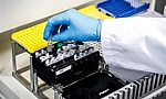 Nghiên cứu tia cực tím tiêu diệt virus SARS-CoV-2
