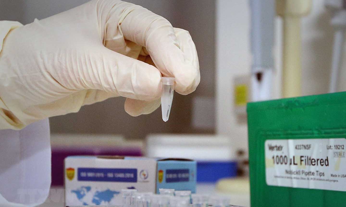 Test xác định virus SARS-CoV-2. (Ảnh: Dương Giang/TTXVN)