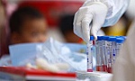 Bộ kit xét nghiệm COVID-19 đầu tiên dựa trên công nghệ chỉnh sửa gene