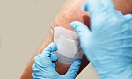 Miếng dán đặc biệt giúp vết thương mau lành với bệnh nhân tiểu đường