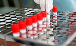 Nhật Bản lấy mẫu xét nghiệm virus SARS-CoV-2 qua nước bọt