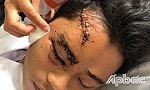 Một trường hợp bị tai nạn giao thông cần giúp đỡ