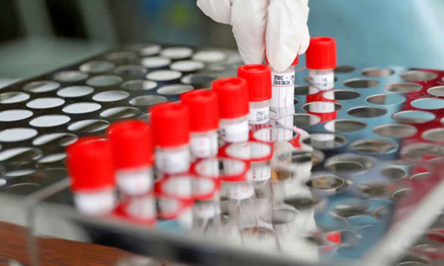 Các mẫu xét nghiệm SARS-CoV-2. (Nguồn: Reuters)