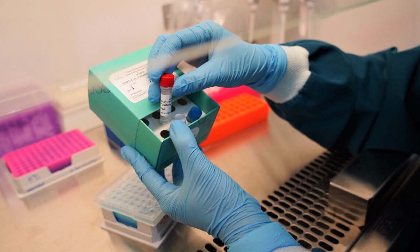 Bộ VinKit SARS-CoV-2 Multiplex RT-PCR đã tăng tốc độ xét nghiệm lên gấp 2 lần so với các bộ Kit đang có trên thị trường 