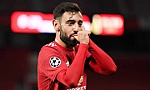 Manchester United đang quá phụ thuộc Bruno Fernandes