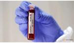 Phát hiện khí ozone có thể khử khuẩn bề mặt có virus SARS-CoV-2