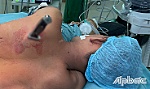 Đánh nhau trong lúc nhậu, 2 người bị thương