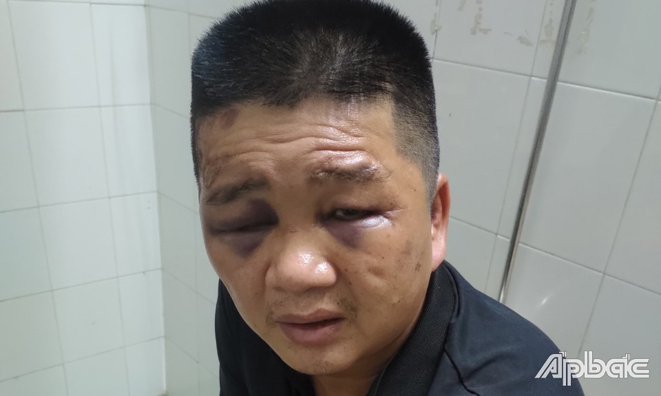Nghi phạm Vũ.
