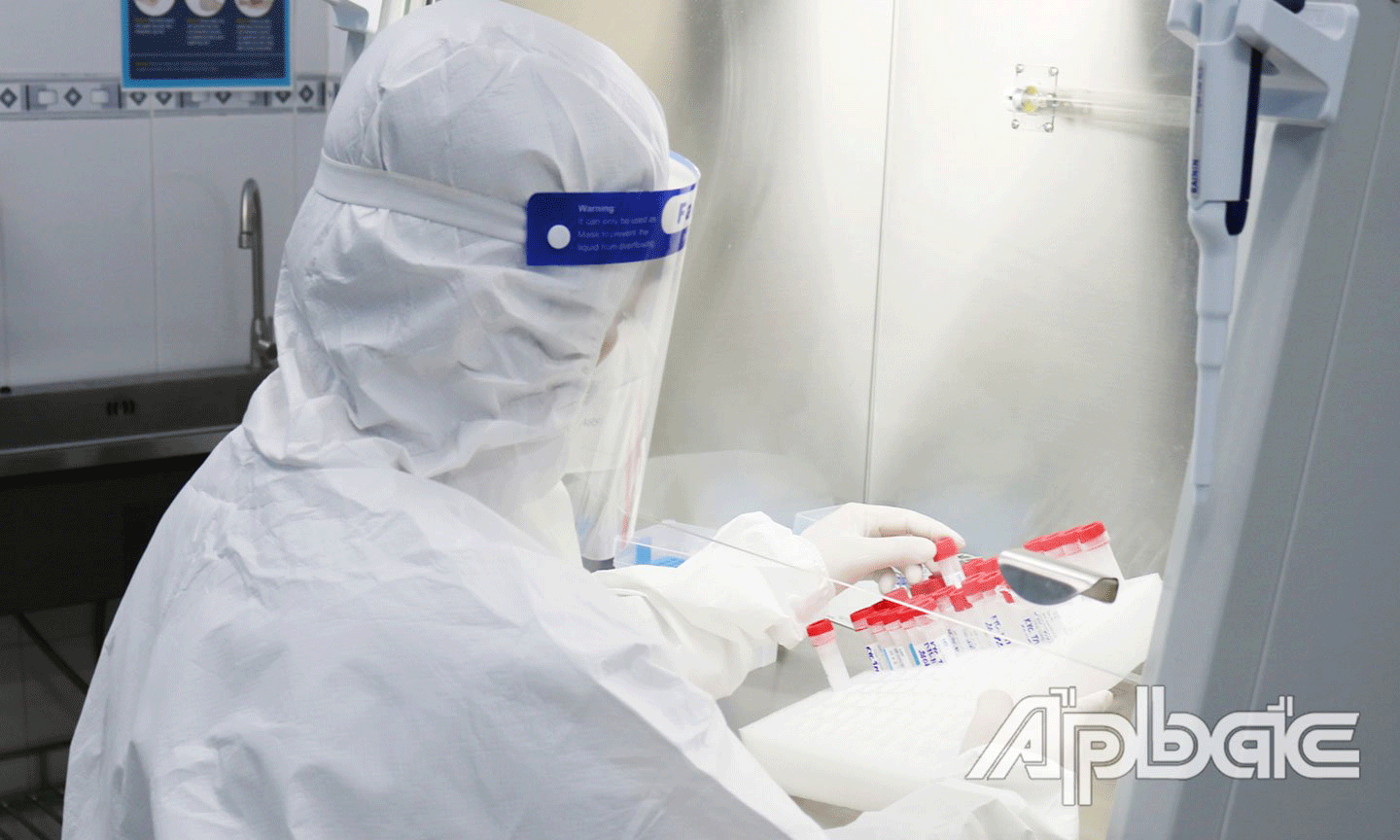 Xét nghiệm SARS-CoV-2 bằng phương pháp RT-PCR đối với các mẫu test nhanh kháng nguyên dương tính trong quá trình tầm soát diện rộng Covid-19 trong cộng đồng.
