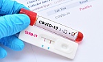 Bộ Y tế: Các địa phương lập đoàn kiểm tra việc kinh doanh test kit xét nghiệm nhanh và PCR