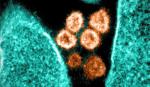 Thiết bị lọc không khí có thể loại bỏ virus SARS-CoV-2 lơ lửng