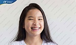 Niềng răng cho trẻ 14 tuổi