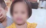 Xác định nghi phạm trong vụ bé gái 3 tuổi bị nhiều đinh găm vào đầu