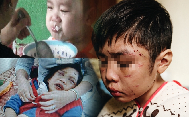 Các vụ bạo hành trẻ em diễn ra dồn dập chỉ trong thời gian ngắn. (Ảnh minh họa: Soha.vn )