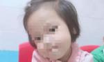 Bé gái 3 tuổi bị người tình của mẹ đóng 9 chiếc đinh vào đầu đã tử vong