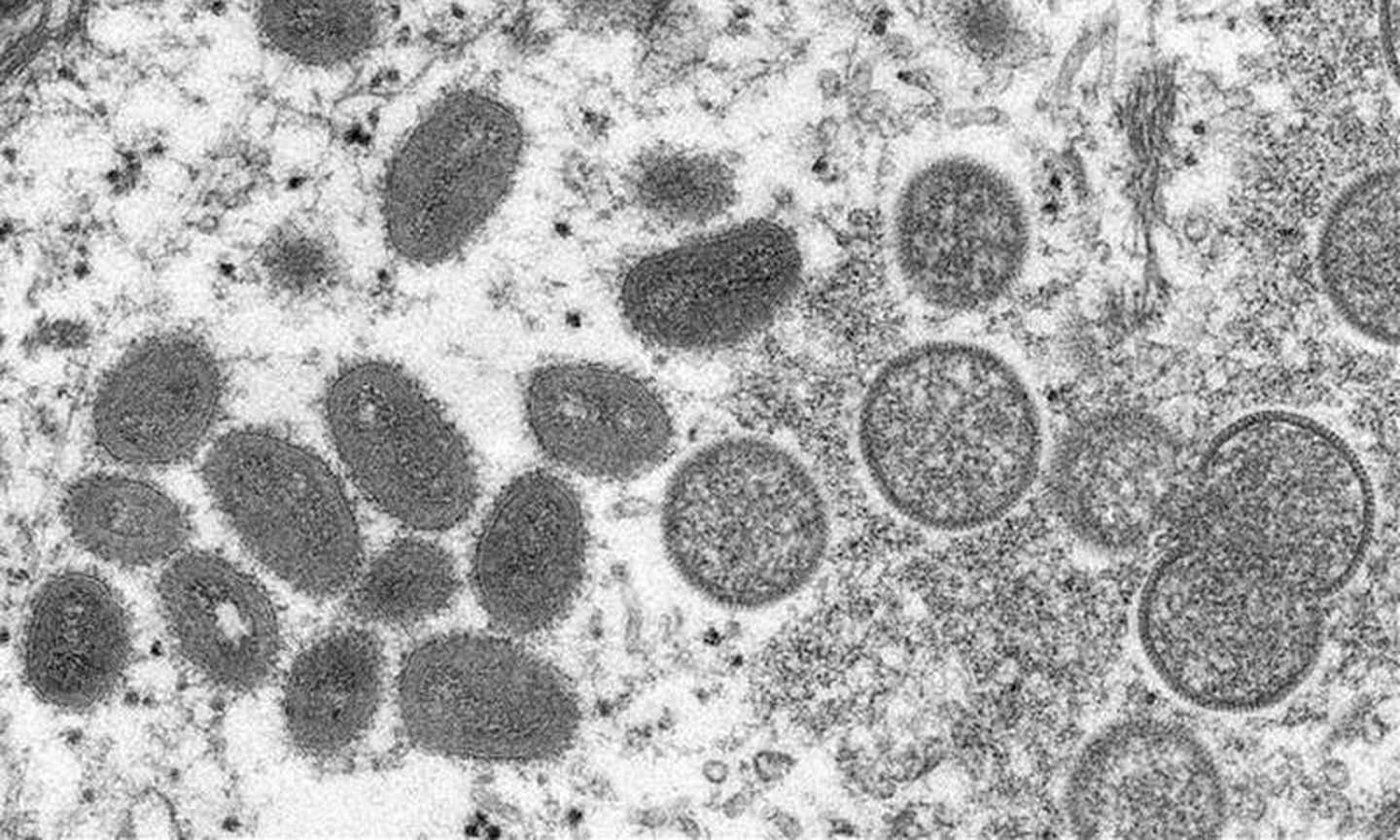 Hình ảnh virus đậu mùa khỉ dưới kính hiển vi điện tử. (Ảnh: AFP/TTXVN)