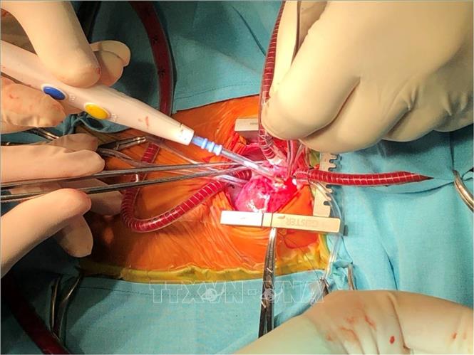 Protamin sulfat là thuốc cầm máu và chống đông máu, thuộc nhóm chuyên khoa, chỉ sử dụng trong quy trình phẫu thuật tim - lồng ngực Ảnh: TTXVN