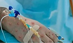 Bệnh nhân đầu tiên mắc đậu mùa khỉ tại Việt Nam là nữ, khởi phát bệnh khi đang đi du lịch