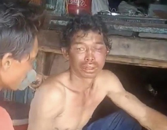 Một trong hai ngư dân bị hành hạ dã man trên tàu cá. Ảnh cắt từ clip
