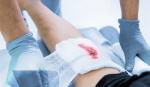 Nghiên cứu đột phá về phương pháp điều trị hiệu quả các vết thương lâu lành