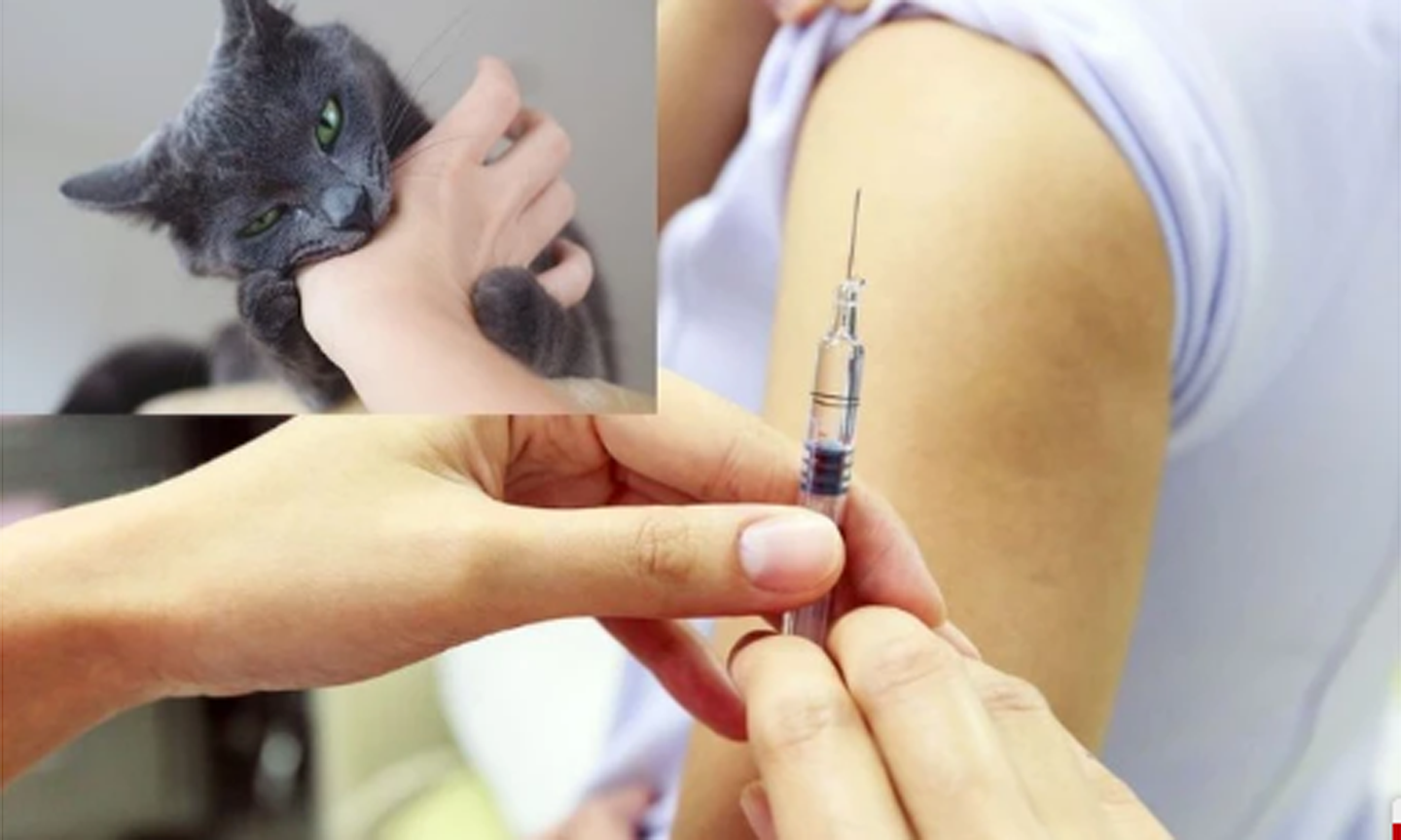 Nhiều người phải đi tiêm phòng do chó, mèo cắn.