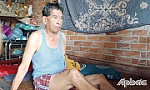 Một nạn nhân chất độc da cam rất cần sự giúp đỡ